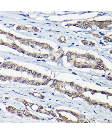 DDIT3/CHOP Rabbit Polyclonal Antibody