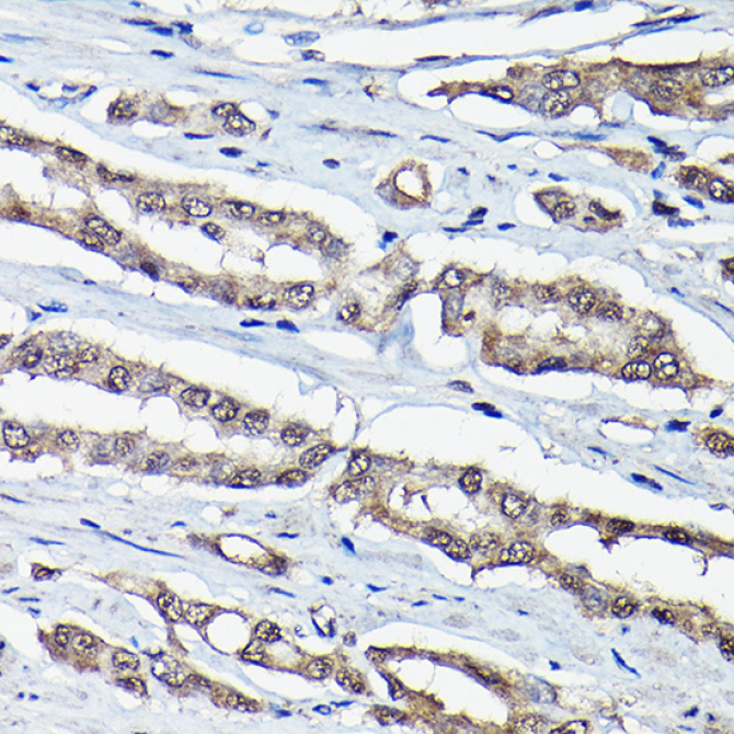 DDIT3/CHOP Rabbit Polyclonal Antibody