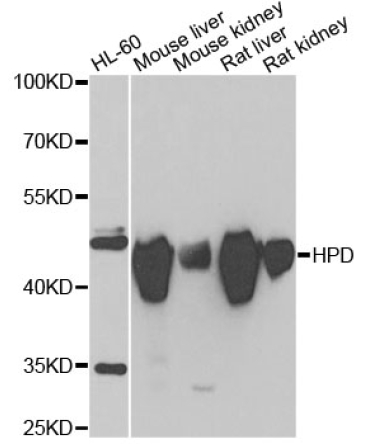 HPD Rabbit Polyclonal Antibody