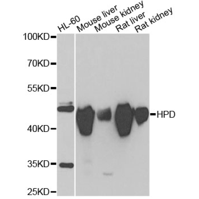 HPD Rabbit Polyclonal Antibody
