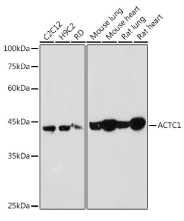 ACTC1 Rabbit Polyclonal Antibody