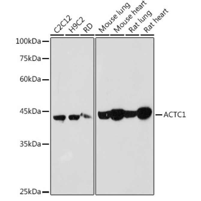 ACTC1 Rabbit Polyclonal Antibody