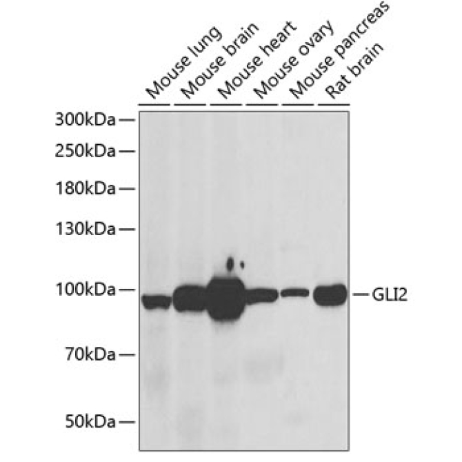 GLI2 Rabbit Polyclonal Antibody