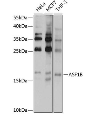 ASF1B Rabbit Polyclonal Antibody