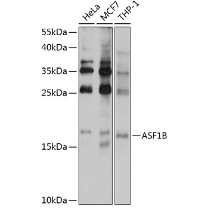 ASF1B Rabbit Polyclonal Antibody
