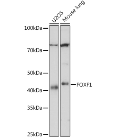 FOXF1 Rabbit Monoclonal Antibody