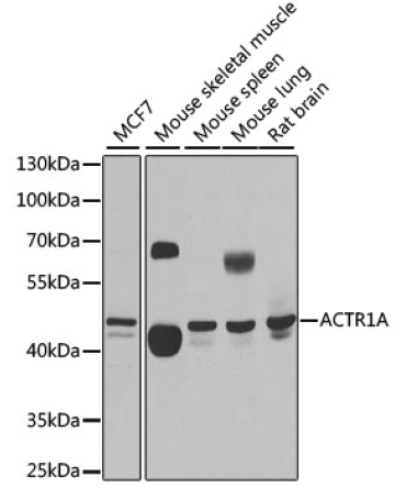 ACTR1A Rabbit Polyclonal Antibody