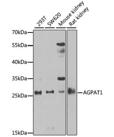 AGPAT1 Rabbit Polyclonal Antibody