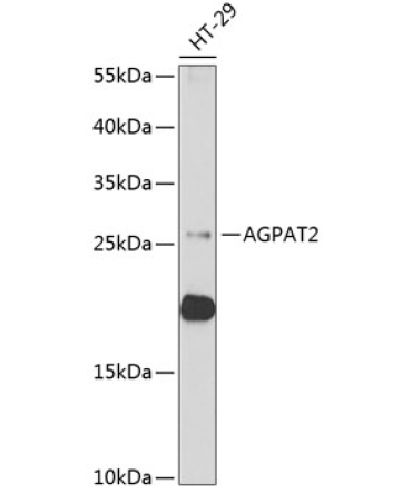 AGPAT2 Rabbit Polyclonal Antibody
