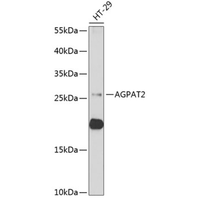 AGPAT2 Rabbit Polyclonal Antibody