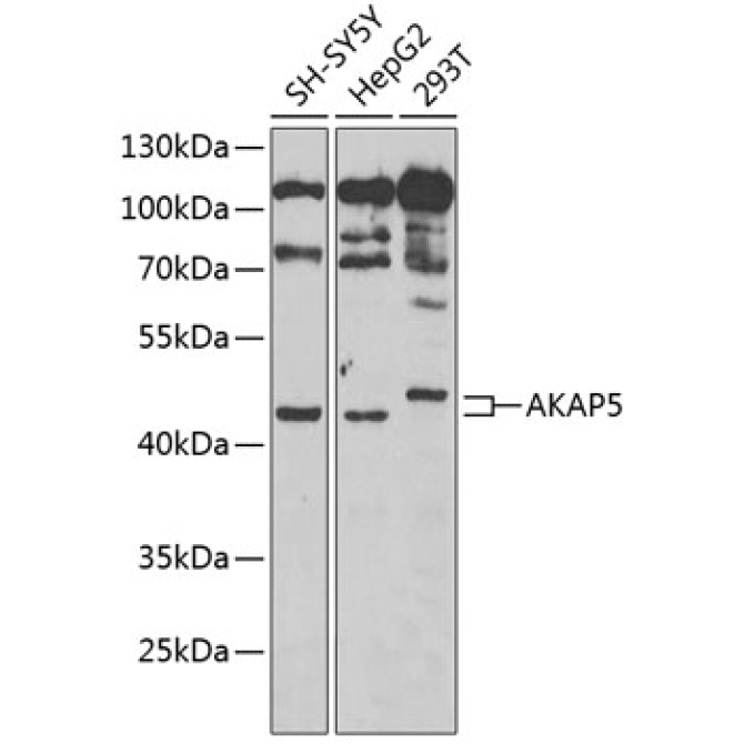 AKAP5 Rabbit Polyclonal Antibody