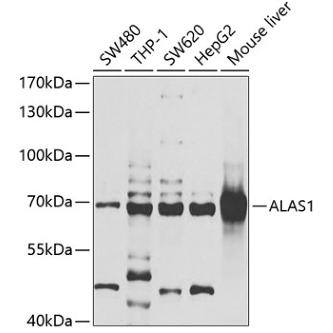ALAS1 Rabbit Polyclonal Antibody