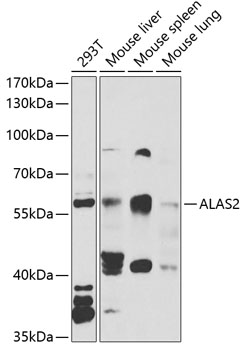 ALAS2 Rabbit Polyclonal Antibody