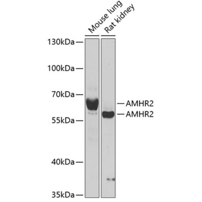AMHR2 Rabbit Polyclonal Antibody