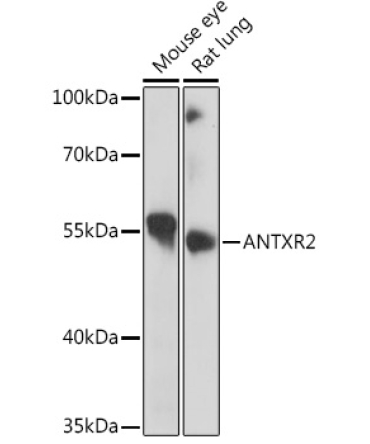 ANTXR2 Rabbit Polyclonal Antibody