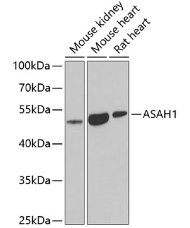 ASAH1 Rabbit Polyclonal Antibody