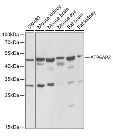 ATP6AP2 Rabbit Polyclonal Antibody