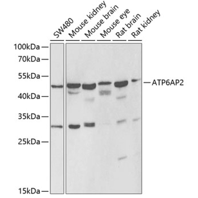 ATP6AP2 Rabbit Polyclonal Antibody
