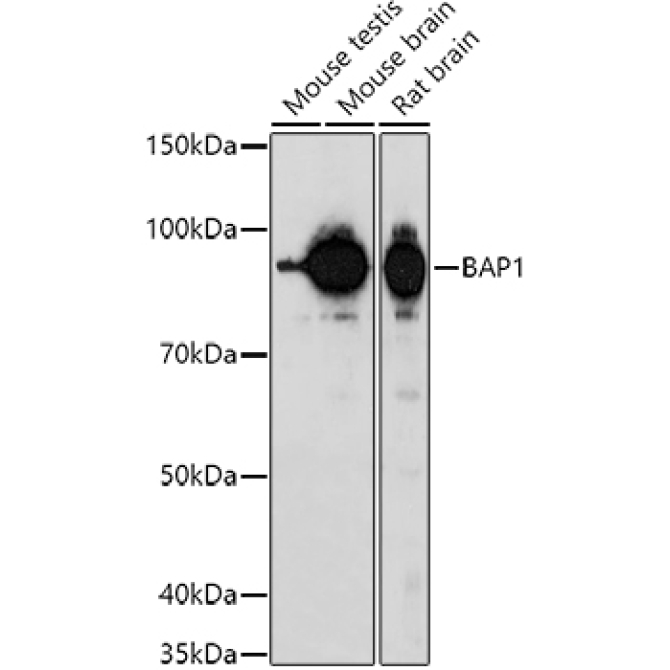 BAP1 Rabbit Polyclonal Antibody