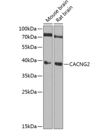 CACNG2 Rabbit Polyclonal Antibody