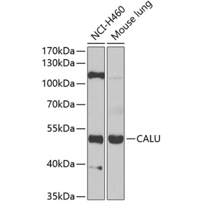 CALU Rabbit Polyclonal Antibody
