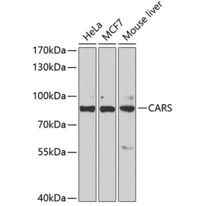 CARS Rabbit Polyclonal Antibody