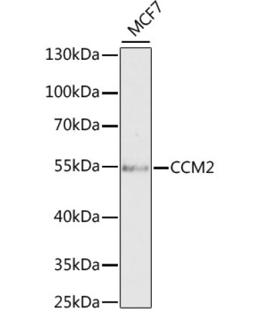 CCM2 Rabbit Polyclonal Antibody