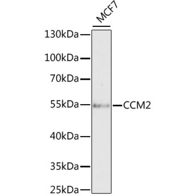 CCM2 Rabbit Polyclonal Antibody