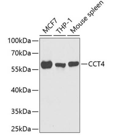 CCT4 Rabbit Polyclonal Antibody