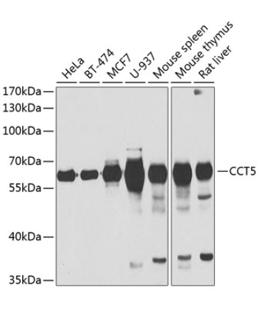 CCT5 Rabbit Polyclonal Antibody