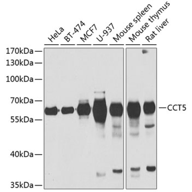CCT5 Rabbit Polyclonal Antibody