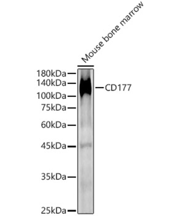CD177 Rabbit Polyclonal Antibody