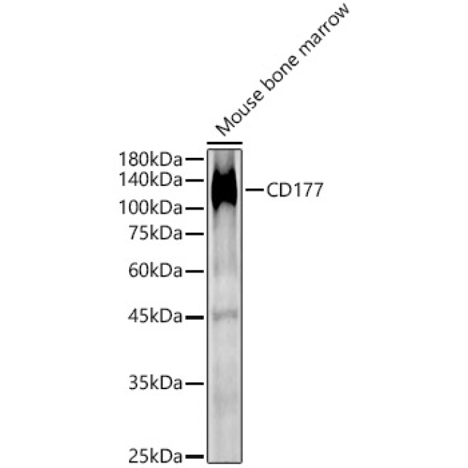 CD177 Rabbit Polyclonal Antibody