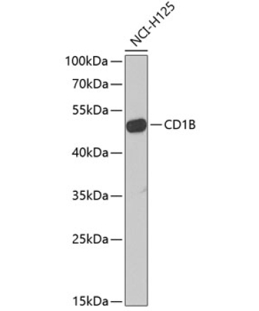 CD1B Rabbit Polyclonal Antibody