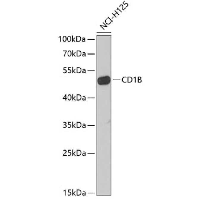 CD1B Rabbit Polyclonal Antibody