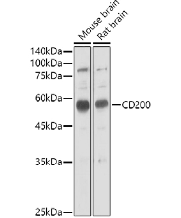 CD200 Rabbit Polyclonal Antibody