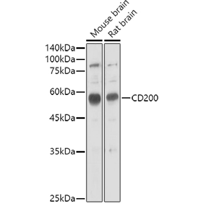 CD200 Rabbit Polyclonal Antibody