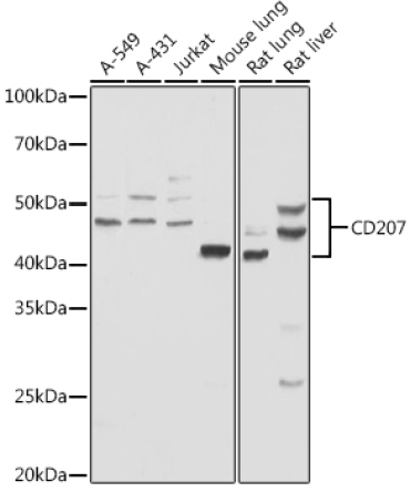 Langerin/CD207 Rabbit Polyclonal Antibody