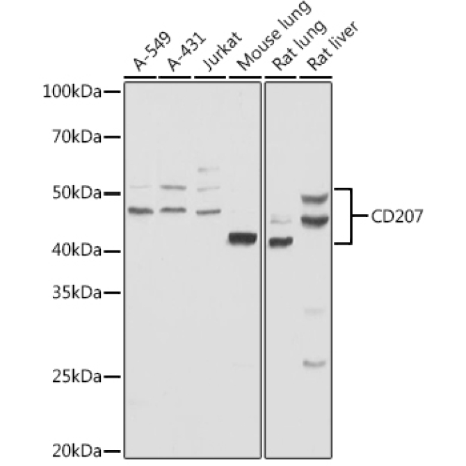 Langerin/CD207 Rabbit Polyclonal Antibody