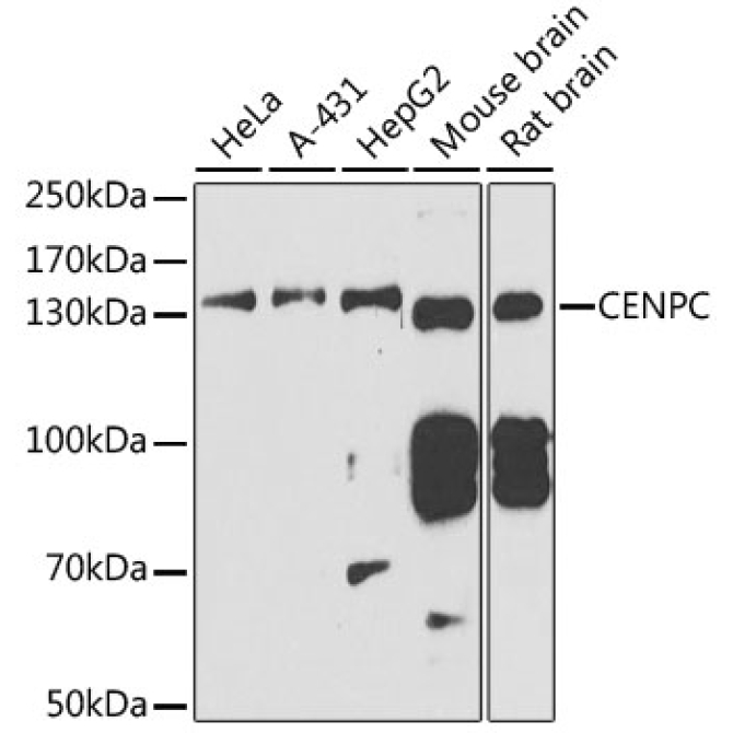 CENPC Rabbit Polyclonal Antibody