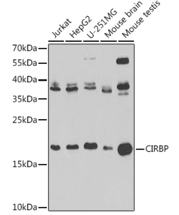 CIRBP Rabbit Polyclonal Antibody [KO Validated]