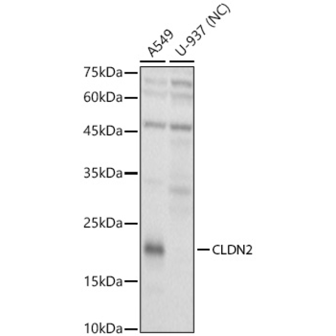 CLDN2 Rabbit Polyclonal Antibody