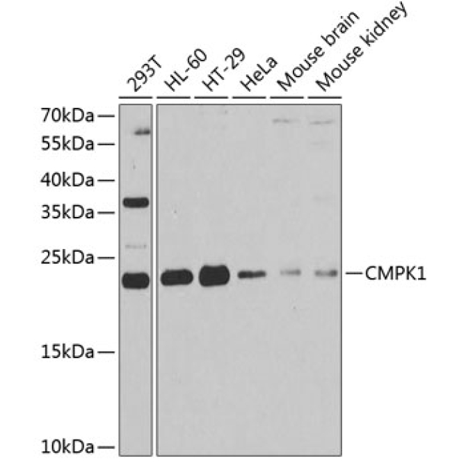 CMPK1 Rabbit Polyclonal Antibody
