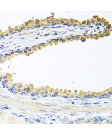 COCH Rabbit Polyclonal Antibody