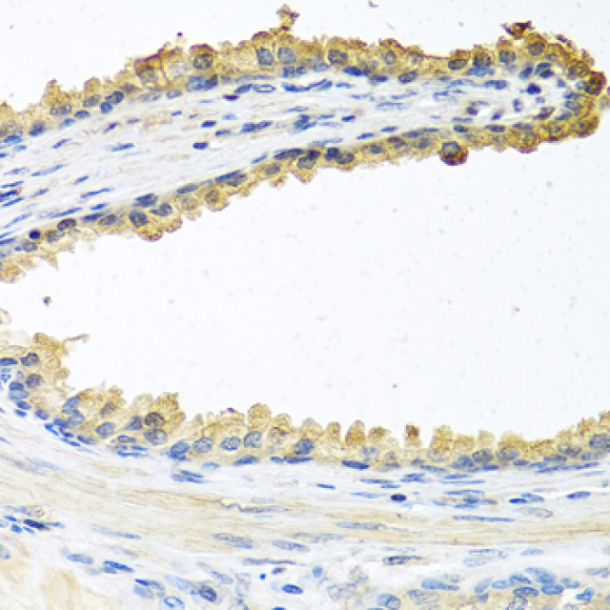 COCH Rabbit Polyclonal Antibody