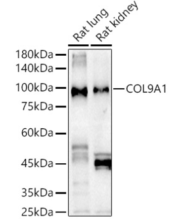 COL9A1 Rabbit Polyclonal Antibody