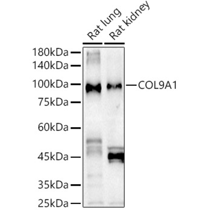 COL9A1 Rabbit Polyclonal Antibody