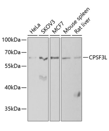 CPSF3L Rabbit Polyclonal Antibody
