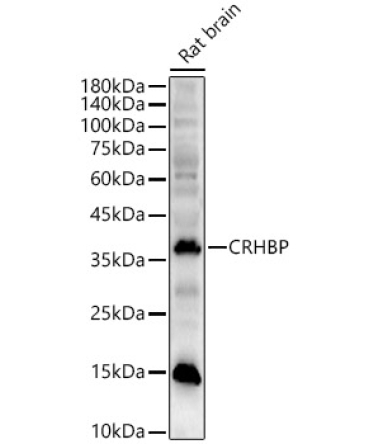 CRHBP Rabbit Polyclonal Antibody