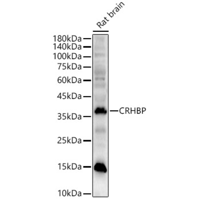CRHBP Rabbit Polyclonal Antibody